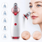 Derma Suction & Black Head Remover - smartishTrend